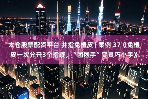 太仓股票配资平台 并指免植皮 | 案例 37《免植皮一次分开3个指蹼，“团团手”变灵巧小手》